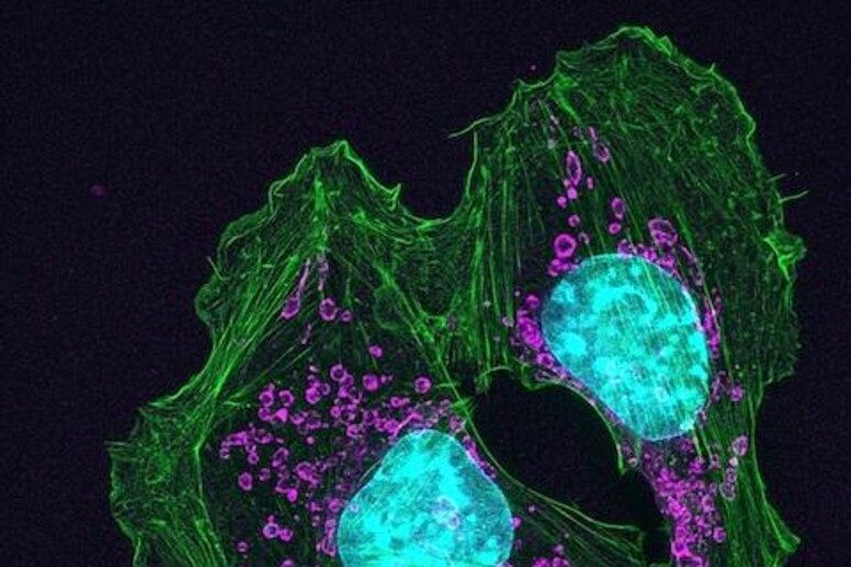 Una cellula cancerogena della pelle (fonte: Knight Cancer Institute) - RIPRODUZIONE RISERVATA