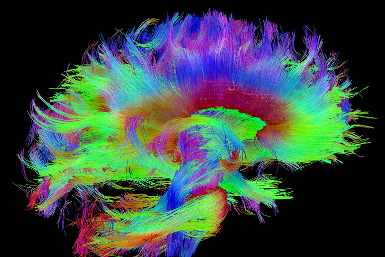 Apre il più grande laboratorio virtuale sul cervello (fonte: Courtesy of the Laboratory of Neuro Imaging and Martinos Center for Biomedical Imaging, Consortium of the Human Connectome Project) - RIPRODUZIONE RISERVATA