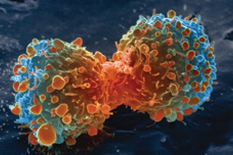 Una cellula tumore nel momento in cui si divide (fonte: United States: National Institutes of Health) - RIPRODUZIONE RISERVATA