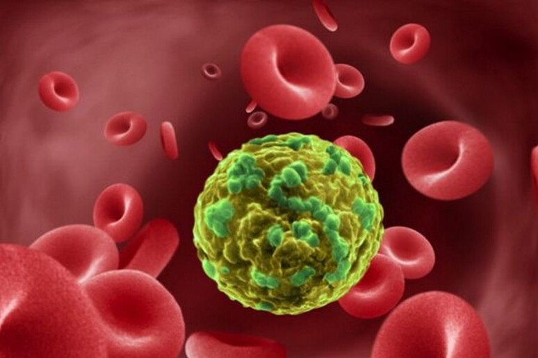 La tecnica che riconosce nel sangue Dna e proteine dei tumori apre le porte alla diagnosi precoce non invasiva (fonte: Stanford University) - RIPRODUZIONE RISERVATA