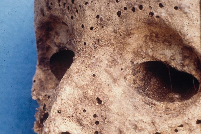 I resti mummificati del bambino del XVI secolo con il virus dell 'epatite B (fonte: Gino Fornaciari, Università di Pisa) - RIPRODUZIONE RISERVATA