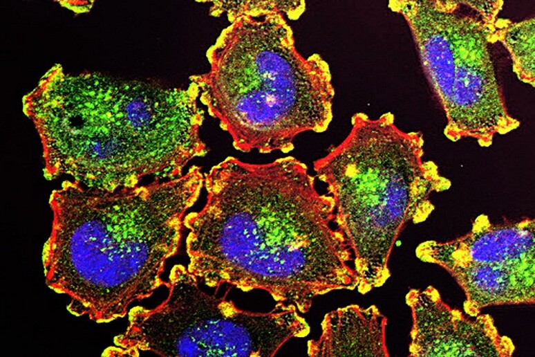 Positivi i primi test sul melanoma dei nuovi farmaci epigenetici duali (fonte: NCI) - RIPRODUZIONE RISERVATA