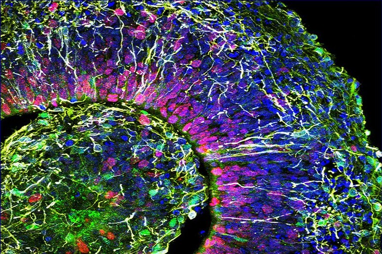 Un mini cervello visto al microscopio (fonte: Muotri Lab/UC San Diego) - RIPRODUZIONE RISERVATA