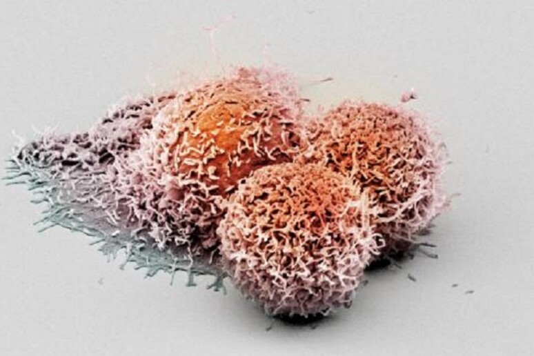 Cellule tumorali (fonte: University of Basel, Biozentrum/Swiss Nanoscience Institute) - RIPRODUZIONE RISERVATA