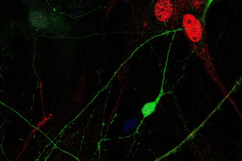 Le cellule della pelle trasformate in neuroni hanno permesso di studiare i meccanismi dell 'epilessia (fonte: IIT) - RIPRODUZIONE RISERVATA