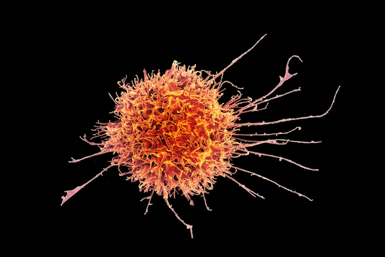 Una cellula immunitaria umana (fonte: NIH Image Gallery) - RIPRODUZIONE RISERVATA