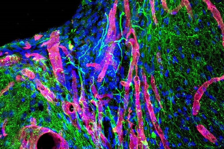 Il tessuto cerebrale riparato nel topo grazie al gel biotech (fonte: UCLA Health) - RIPRODUZIONE RISERVATA
