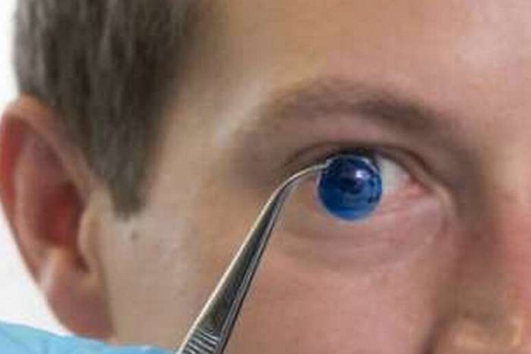 La cornea stampata in 3D con le cellule staminali umane (fonte: Newcastle University) - RIPRODUZIONE RISERVATA