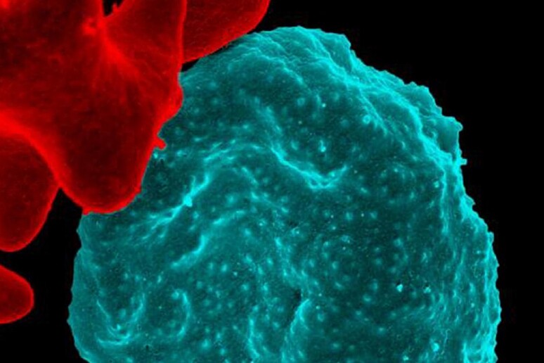 In blu una callula del sangue infettata dal parassita della malaria (fonte: NIAID-NIH) - RIPRODUZIONE RISERVATA