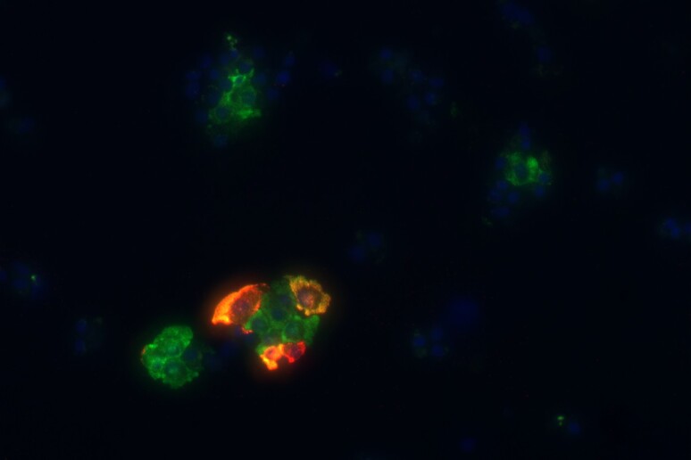 Cellule umane del pancreas dopo l 'infezione con il virus dell 'influenza H1N1 (fonte: San Raffaele Diabetes Research Institute) - RIPRODUZIONE RISERVATA
