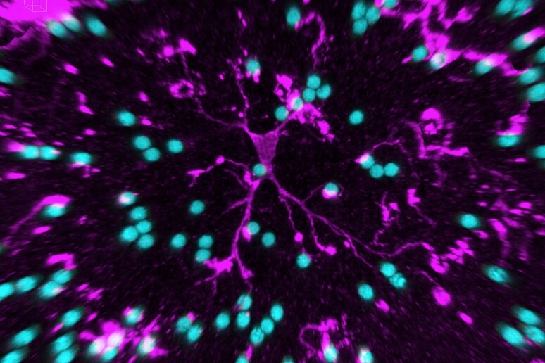 In rosa le cellule della microglia che proteggono il cervello (fonte: Susanne Wolf, MDC) - RIPRODUZIONE RISERVATA