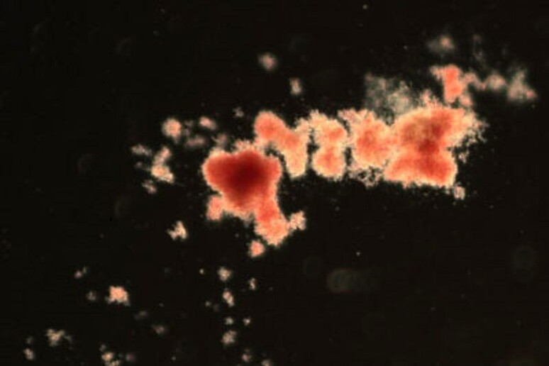 Una colonia di cellule del sangue sviluppata a partire da una singola cellula, isolata da un uomo di 59 anni (fonte: Mairi Shepherd, Kent Lab) - RIPRODUZIONE RISERVATA