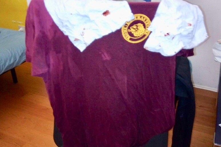 La maglietta insanguinata di uno dei ragazzi del cinema America dopo l 'aggressione avvenuta a Trastevere, nel centro di Roma, lo scorso 16 giugno. - RIPRODUZIONE RISERVATA