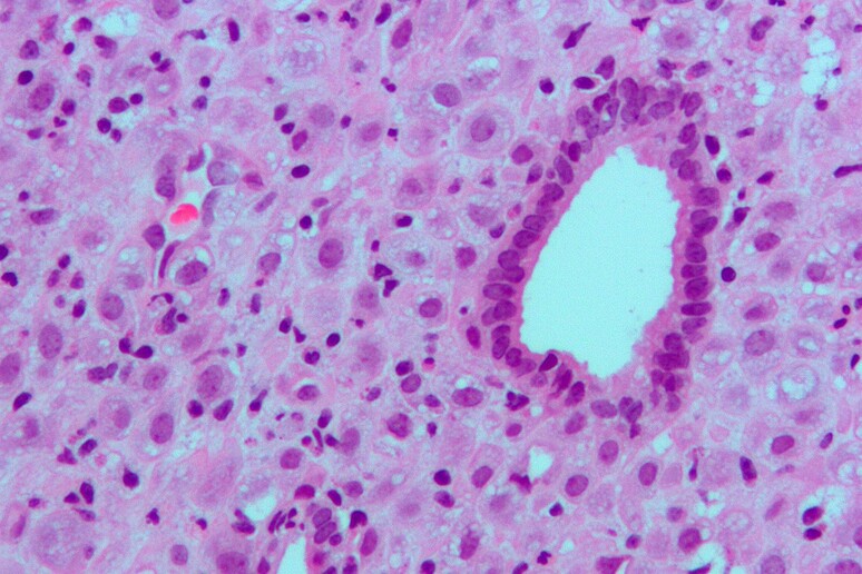 Tessuto dell 'endometrio (fonte: Nephron, Wikipedia) - RIPRODUZIONE RISERVATA