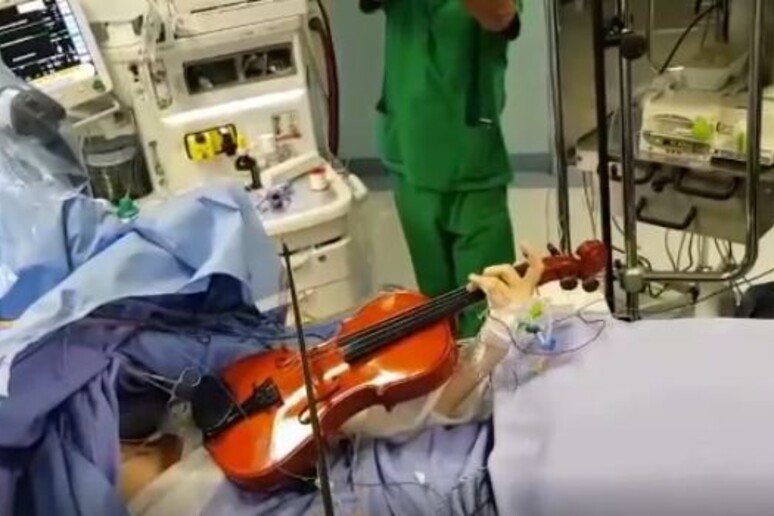 Operata al cervello a Taranto mentre suona il violino - RIPRODUZIONE RISERVATA