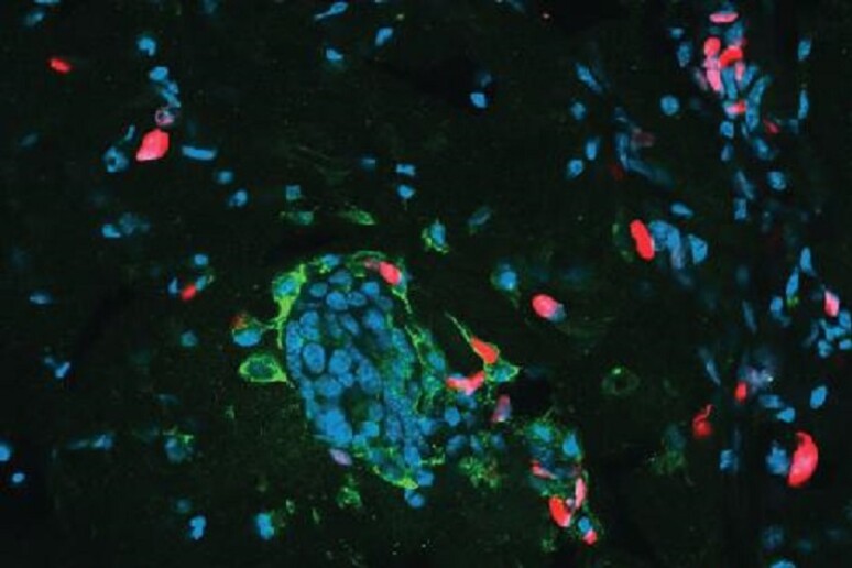 Cellule tumorali di topo. In rosso le cellule divorate dalle loro simili (in verde) (fonte: Tonnessen-Murray et al., 2019) - RIPRODUZIONE RISERVATA