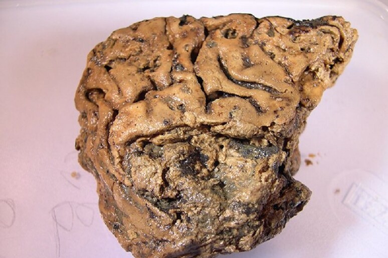 Il frammento di cervello rinvenuto conservato per 2.600 anni (fonte: Dr Axel Petzold) - RIPRODUZIONE RISERVATA