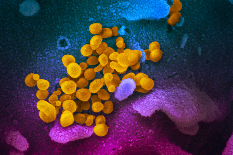 Particelle del coronavirus SarsCov2 sulla superficie di una cellula, ottenute dal Niaid (fonte: NIAID-RML) - RIPRODUZIONE RISERVATA