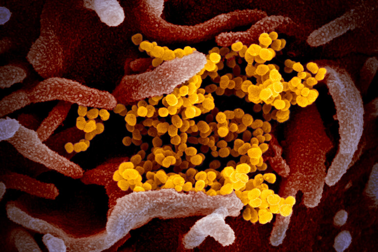 Una delle immagini del coronavirus SarsCov2 ottenute dal Niaid con il microscopio elettronico (fonte: NIAID-RML) - RIPRODUZIONE RISERVATA