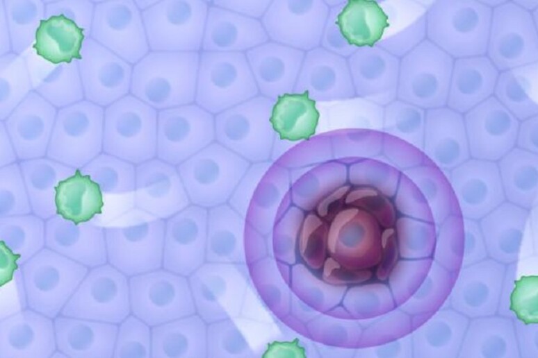 Cellule tumorali possono continuare a replicarsi perché si nascondono al sistema immunitario (fonte: CIBSS/University of Freiburg, Michal Roessler) - RIPRODUZIONE RISERVATA