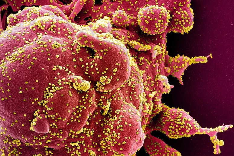 In giallo le particelle del coronavirus SarsCoV2 (fonte: NIAID) - RIPRODUZIONE RISERVATA