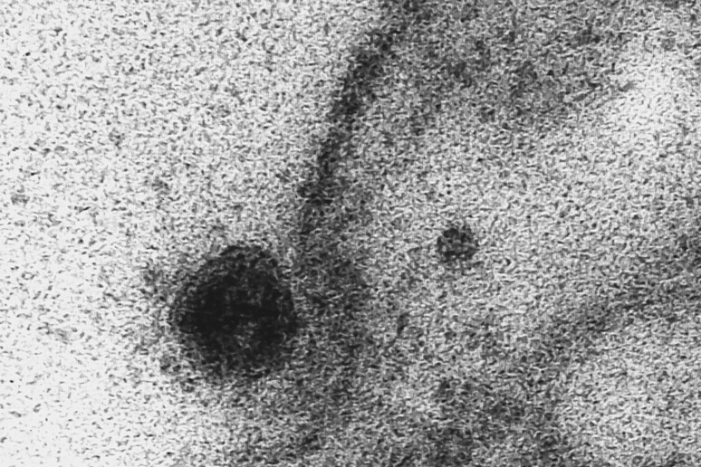 Brazilian scientists capture images of the exact moment when the new coronavirus infects a cell © ANSA/EPA