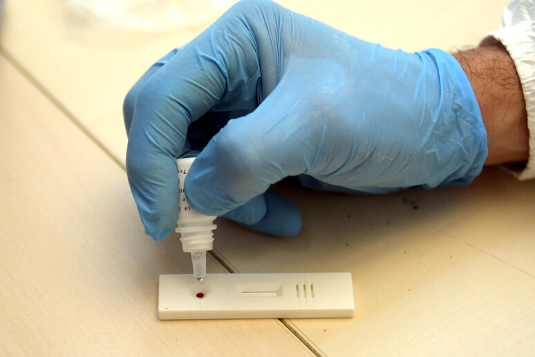 Test sierologici in una foto d 'archivio - RIPRODUZIONE RISERVATA