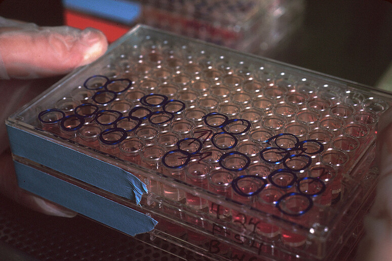 Preparazione di anticorpi monoclonali (foto di Linda Bartlett/ Wikipedia) - RIPRODUZIONE RISERVATA