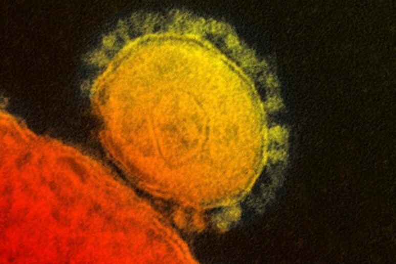 Il Coronavirus al microscopio elettronico (fonte: NIAID-RML) - RIPRODUZIONE RISERVATA