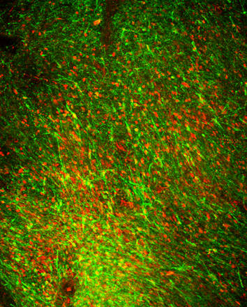 Neuroni dopaminergici derivati da cellule staminali embrionali e impiantati nel cervello di una scimmia con il Parkinson (fonte: Sonja Kriks/Lorenz Studer)