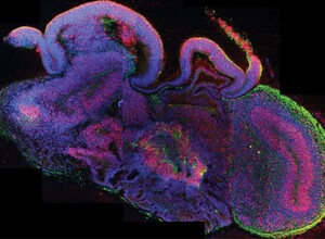 Gli organoidi del cervello sono mini-cervelli? 