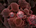 Particelle del virus SarsCoV2 (fonte: NIAID/NIH) (ANSA)