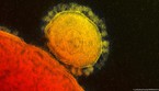 Il coronavirus visto al microscopio elettronico (fonte: NIAID-RML) (ANSA)