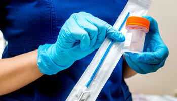 Tumori: a Int piattaforma per processare campioni Pap-Test (ANSA)