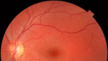 Cellule della retina sono state riattivate dopo la morte (fonte: M. Haggstrom, Wikimedia) (ANSA)