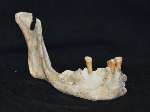 Oplontis, mascella con dentatura deteriorata © ANSA
