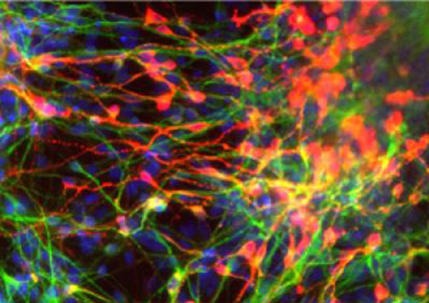 Cellule staminali adulte del cervello (fonte: UC San Diego School of Medicine) © ANSA 