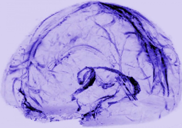 Rappresentazione grafica del sistema con cui il cervello drena le sostanze di scarto (fonte:  Reich Lab, NIH/NINDS) © Ansa