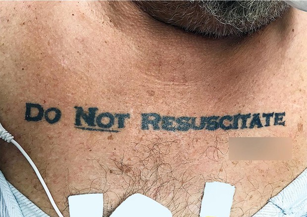 Uomo con tatuaggio 'Non rianimare' © ANSA