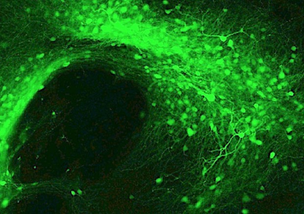 I neuroni del nucelo accumbens, la regione del cervello coinvolta nella dipendenza (fonte: Christopher W. Cowan, MUSC) © Ansa