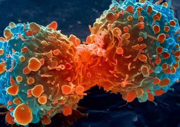 Cellula del tumore del polmone in fase di divisione (fonte: National Institutes of Health) © Ansa
