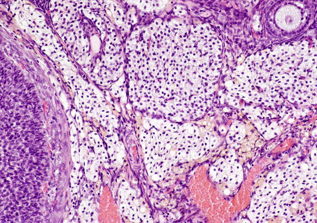 Cellule del tessuto interstiziale (fonte: National Toxicologic Program) © Ansa