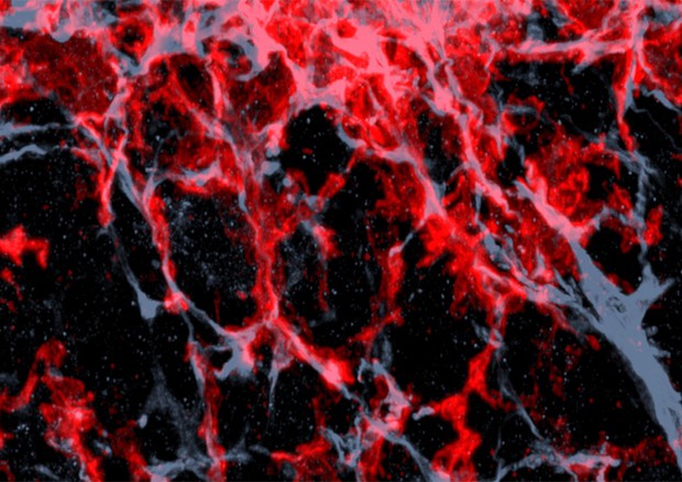 Tessuto tumorale di topo nel quale sono evidenziati i macrofaci, le cellule del sistema immunitario che vengono indotte ad aiutare la crescita dei tumori (fonte: Tim Lämmermann, Max Planck Institute of Biochemistry) © Ansa