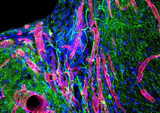 Il tessuto cerebrale riparato nel topo grazie al gel biotech (fonte: UCLA Health) © Ansa