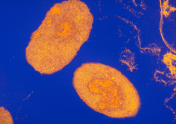 Il batterio della pertosse, il Bordetella pertussis (fonte: Sanofi Pasteur, Flickr) © Ansa