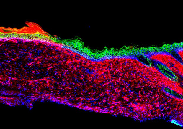  Le cellule della ferita, evidenziate in rosso, vengono riprogrammate in cellule precursori della pelle, in verde (fonte: Salk Institute) © Ansa