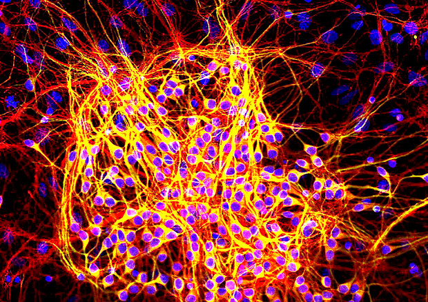 Neuroni fatti sviluppare in coltura con la proteina Map2 (fonte: GerryShaw, Wikipedia) © Ansa