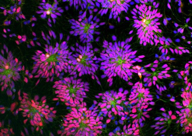 Cellule staminali umane riprogrammate a partire da neuroni (fonte: Yichen Shi e Rick Livesey, Gurdon Institute, University of Cambridge) © Ansa
