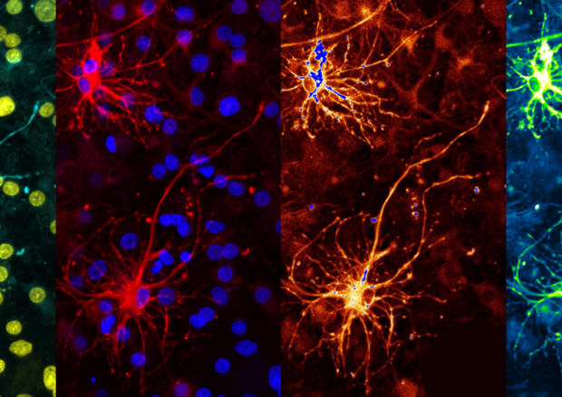 Neuroni (fonte: Enricobagnoli, Wikipedia) © Ansa