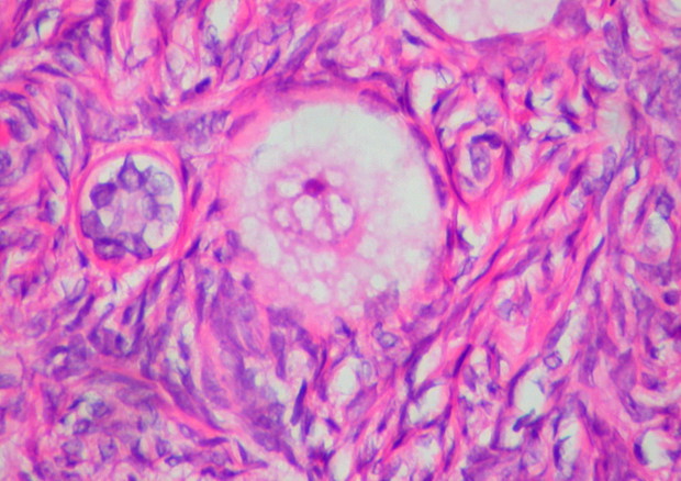 Ovocita e tessuto ovarico (fonte: Ed Uthman from Houston, TX, USA, da Wikipedia) © Ansa